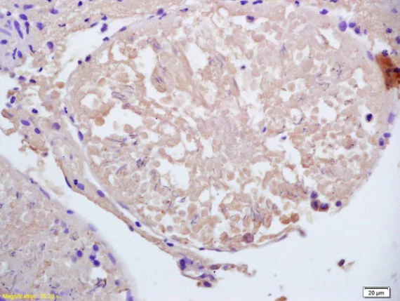 Immunohistochemistry (Formalin/PFA-fixed paraffin-embedded sections) - Anti-CCDC11 antibody (AB213153)