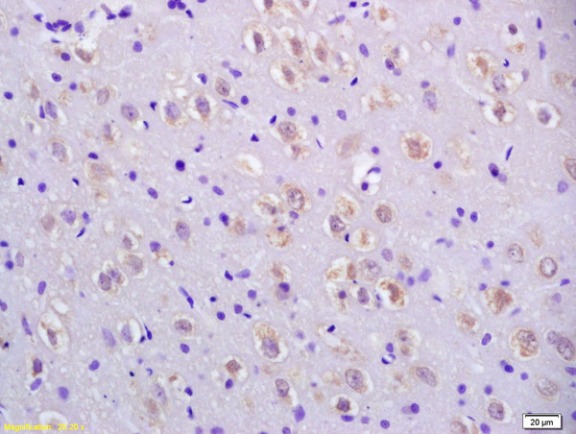Immunohistochemistry (Formalin/PFA-fixed paraffin-embedded sections) - Anti-CCDC11 antibody (AB213153)