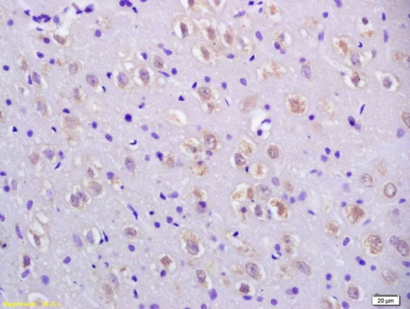 Immunohistochemistry (Formalin/PFA-fixed paraffin-embedded sections) - Anti-CCDC11 antibody (AB213153)