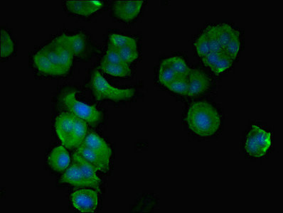 Immunocytochemistry/ Immunofluorescence - Anti-CCDC112 antibody (AB237742), expandable thumbnail