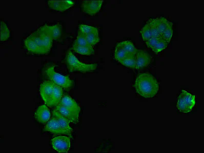 Immunocytochemistry/ Immunofluorescence - Anti-CCDC112 antibody (AB237742)