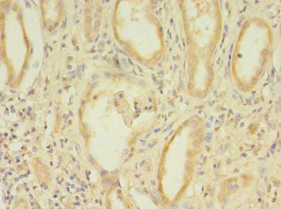 Immunohistochemistry (Formalin/PFA-fixed paraffin-embedded sections) - Anti-CCDC112 antibody (AB237742), expandable thumbnail