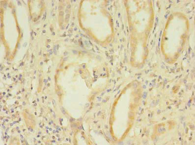 Immunohistochemistry (Formalin/PFA-fixed paraffin-embedded sections) - Anti-CCDC112 antibody (AB237742)