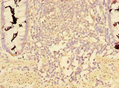 Immunohistochemistry (Formalin/PFA-fixed paraffin-embedded sections) - Anti-CCDC112 antibody (AB237742), expandable thumbnail