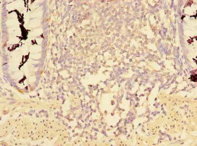 Immunohistochemistry (Formalin/PFA-fixed paraffin-embedded sections) - Anti-CCDC112 antibody (AB237742)