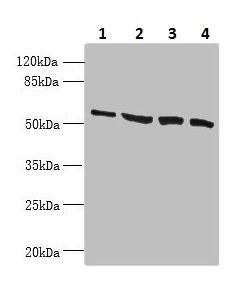Western blot - Anti-CCDC112 antibody (AB237742), expandable thumbnail