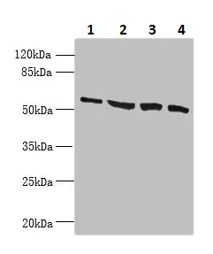 Western blot - Anti-CCDC112 antibody (AB237742)