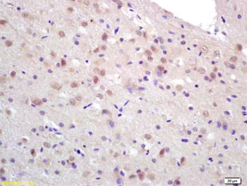 Immunohistochemistry (Formalin/PFA-fixed paraffin-embedded sections) - Anti-CCDC12 antibody (AB203656)