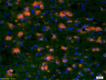 Immunohistochemistry (Formalin/PFA-fixed paraffin-embedded sections) - Anti-CCDC12 antibody (AB203656), expandable thumbnail
