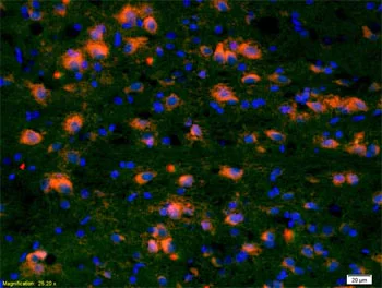 Immunohistochemistry (Formalin/PFA-fixed paraffin-embedded sections) - Anti-CCDC12 antibody (AB203656)