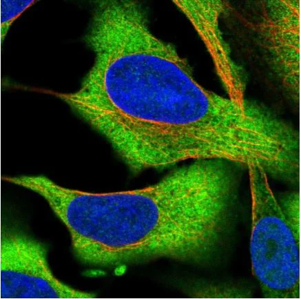 Immunocytochemistry/ Immunofluorescence - Anti-CCDC124 antibody (AB184771)