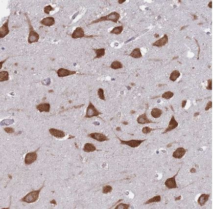Immunohistochemistry (Formalin/PFA-fixed paraffin-embedded sections) - Anti-CCDC124 antibody (AB184771)