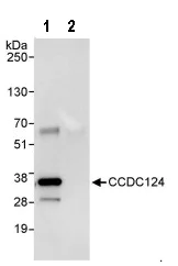 Immunoprecipitation - Anti-CCDC124 antibody (AB86079)
