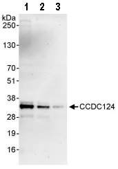 Western blot - Anti-CCDC124 antibody (AB86079)