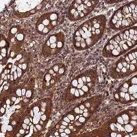 Immunohistochemistry (Formalin/PFA-fixed paraffin-embedded sections) - Anti-CCDC125 antibody (AB122750)