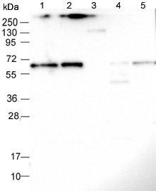 Western blot - Anti-CCDC125 antibody (AB122750)