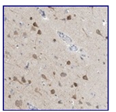 Immunohistochemistry (Formalin/PFA-fixed paraffin-embedded sections) - Anti-CCDC14 antibody (AB122262)
