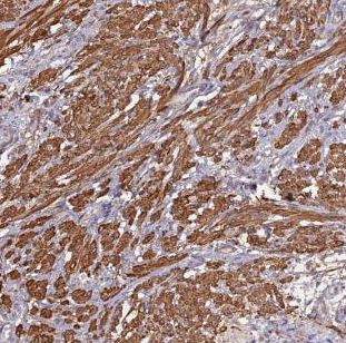Immunohistochemistry (Formalin/PFA-fixed paraffin-embedded sections) - Anti-CCDC154 antibody (AB184841), expandable thumbnail