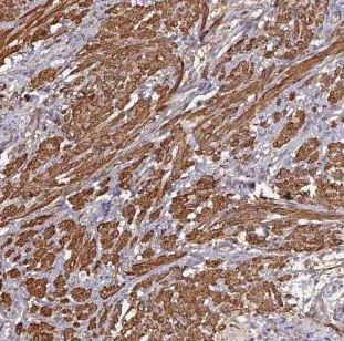 Immunohistochemistry (Formalin/PFA-fixed paraffin-embedded sections) - Anti-CCDC154 antibody (AB184841)