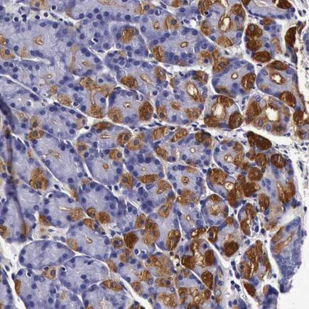 Immunohistochemistry (Formalin/PFA-fixed paraffin-embedded sections) - Anti-CCDC22/JM1 antibody (AB224038)