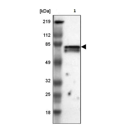 Western blot - Anti-CCDC22/JM1 antibody (AB224038)