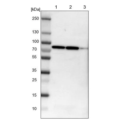 Western blot - Anti-CCDC22/JM1 antibody (AB224038)