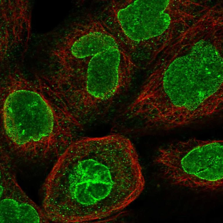 Immunocytochemistry/ Immunofluorescence - Anti-CCDC34/L15 antibody (AB122396)