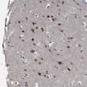 Immunohistochemistry (Formalin/PFA-fixed paraffin-embedded sections) - Anti-CCDC34/L15 antibody (AB122396), expandable thumbnail
