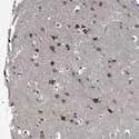Immunohistochemistry (Formalin/PFA-fixed paraffin-embedded sections) - Anti-CCDC34/L15 antibody (AB122396)