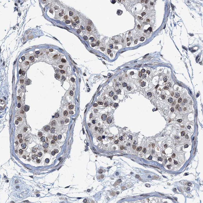 Immunohistochemistry (Formalin/PFA-fixed paraffin-embedded sections) - Anti-CCDC34/L15 antibody (AB122396), expandable thumbnail