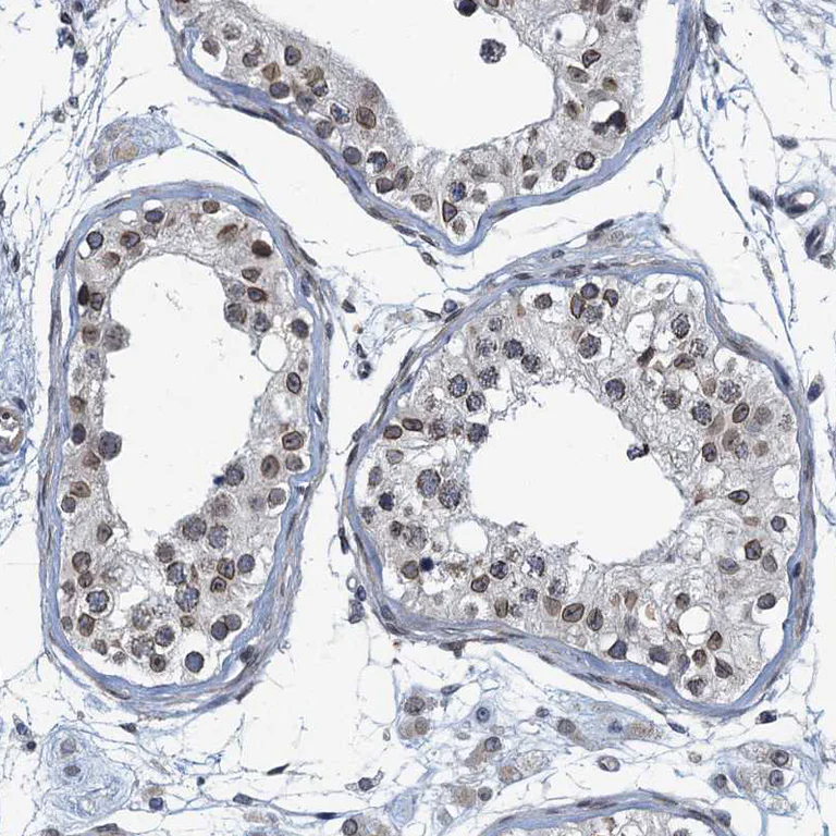 Immunohistochemistry (Formalin/PFA-fixed paraffin-embedded sections) - Anti-CCDC34/L15 antibody (AB122396)