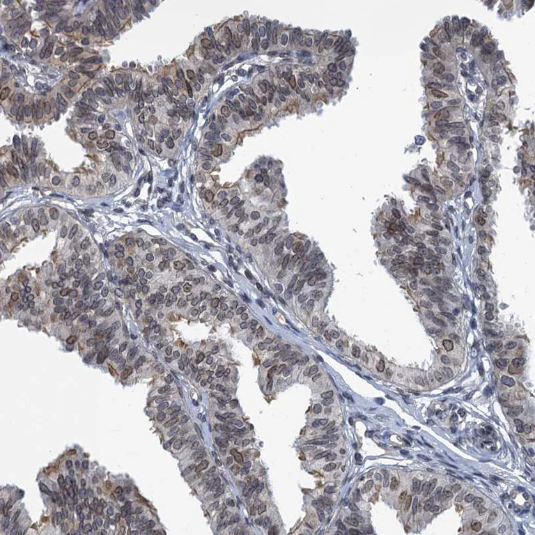 Immunohistochemistry (Formalin/PFA-fixed paraffin-embedded sections) - Anti-CCDC34/L15 antibody (AB122396)