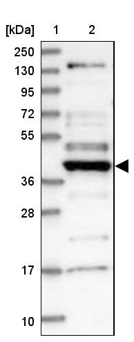 Western blot - Anti-CCDC34/L15 antibody (AB122396), expandable thumbnail