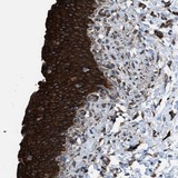 Immunohistochemistry (Formalin/PFA-fixed paraffin-embedded sections) - Anti-CCDC40 antibody (AB121727), expandable thumbnail