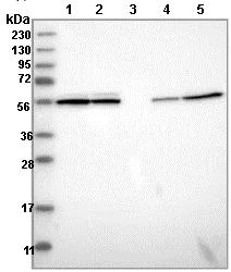 Western blot - Anti-CCDC40 antibody (AB121727)