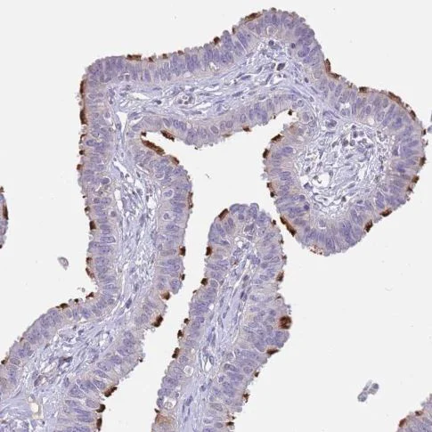 Immunohistochemistry (Formalin/PFA-fixed paraffin-embedded sections) - Anti-CCDC42B antibody (AB151025)