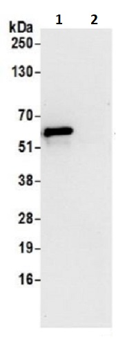 Immunoprecipitation - Anti-CCDC47 antibody (AB241608), expandable thumbnail