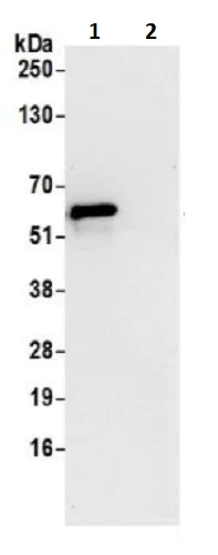 Immunoprecipitation - Anti-CCDC47 antibody (AB241608)