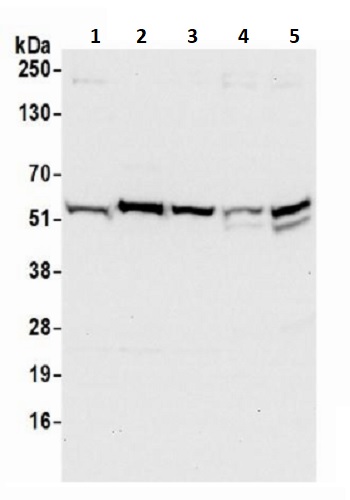 Western blot - Anti-CCDC47 antibody (AB241608), expandable thumbnail