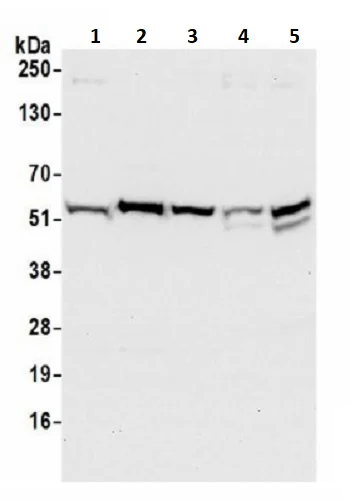 Western blot - Anti-CCDC47 antibody (AB241608)