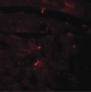 Immunocytochemistry/ Immunofluorescence - Anti-CCDC47 antibody (AB91585)