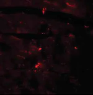 Immunocytochemistry/ Immunofluorescence - Anti-CCDC47 antibody (AB91585)