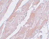 Immunohistochemistry (Formalin/PFA-fixed paraffin-embedded sections) - Anti-CCDC47 antibody (AB91585)