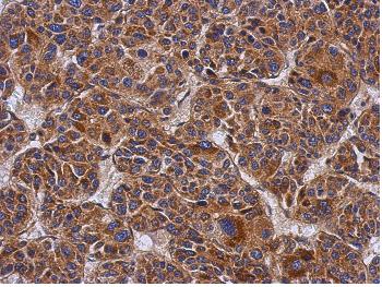 Immunohistochemistry (Formalin/PFA-fixed paraffin-embedded sections) - Anti-CCDC50 antibody (AB127169), expandable thumbnail