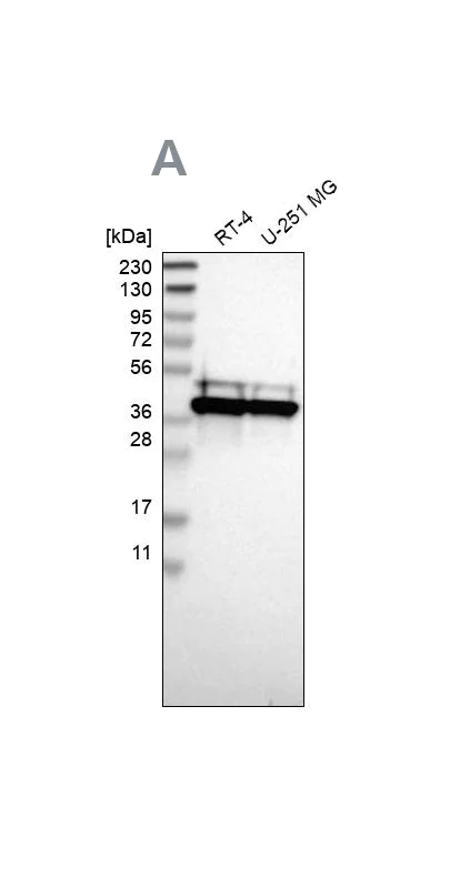 Western blot - Anti-CCDC51 antibody (AB121329)