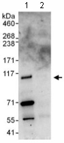 Immunoprecipitation - Anti-CCDC52 antibody (AB117801)