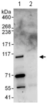 Immunoprecipitation - Anti-CCDC52 antibody (AB117801)