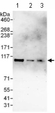 Western blot - Anti-CCDC52 antibody (AB117801)