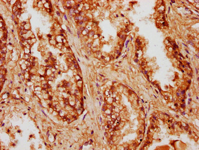 Immunohistochemistry (Formalin/PFA-fixed paraffin-embedded sections) - Anti-CCDC6 antibody (AB235912)