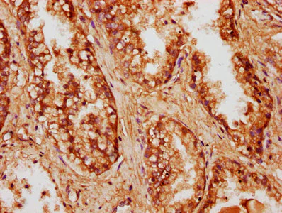 Immunohistochemistry (Formalin/PFA-fixed paraffin-embedded sections) - Anti-CCDC6 antibody (AB235912)
